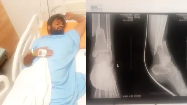 ತಾರ್‌ನಲ್ಲಿ ಗುದ್ದಿ ಬೈಕ್ ಸವಾರನ ಕಾಲು ಮುರಿದ ರಕ್ಷಕ್ – ಬುಲೆಟ್  ಪ್ರಕಾಶ್ ಮಗನ ವಿರುದ್ಧ FIR