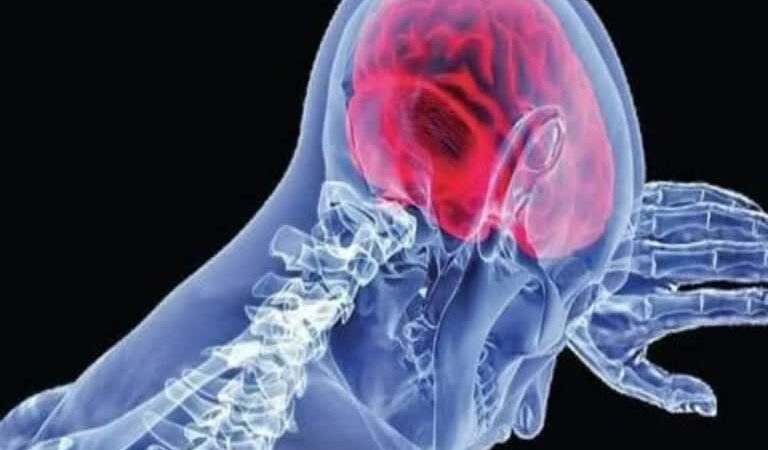 ಮೆದುಳು ತಿನ್ನುವ ಸೋಂಕಿಗೆ ಕೇರಳದಲ್ಲಿ 6ನೇ ಬಲಿ – ಏನಿದು ಮೆದುಳು ತಿನ್ನುವ ಅಮೀಬಾ ಸೋಂಕು?