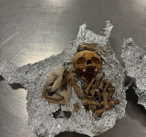 ವಿಮಾನ ನಿಲ್ದಾಣದಲ್ಲಿ ಮಾನವನ ತಲೆಬರುಡೆ ಪತ್ತೆ – ಯಾವ ದೇಶಕ್ಕೆ ಶಿಫ್ಟ್ ಆಗ್ತಾ ಇತ್ತು ಗೊತ್ತಾ?