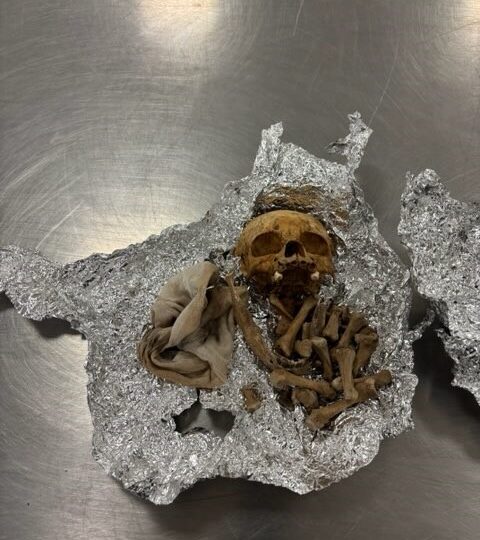 ವಿಮಾನ ನಿಲ್ದಾಣದಲ್ಲಿ ಮಾನವನ ತಲೆಬರುಡೆ ಪತ್ತೆ – ಯಾವ ದೇಶಕ್ಕೆ ಶಿಫ್ಟ್ ಆಗ್ತಾ ಇತ್ತು ಗೊತ್ತಾ?