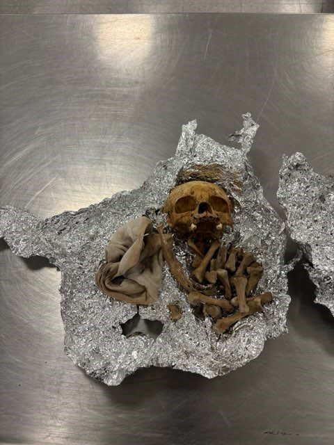 ವಿಮಾನ ನಿಲ್ದಾಣದಲ್ಲಿ ಮಾನವನ ತಲೆಬರುಡೆ ಪತ್ತೆ – ಯಾವ ದೇಶಕ್ಕೆ ಶಿಫ್ಟ್ ಆಗ್ತಾ ಇತ್ತು ಗೊತ್ತಾ?