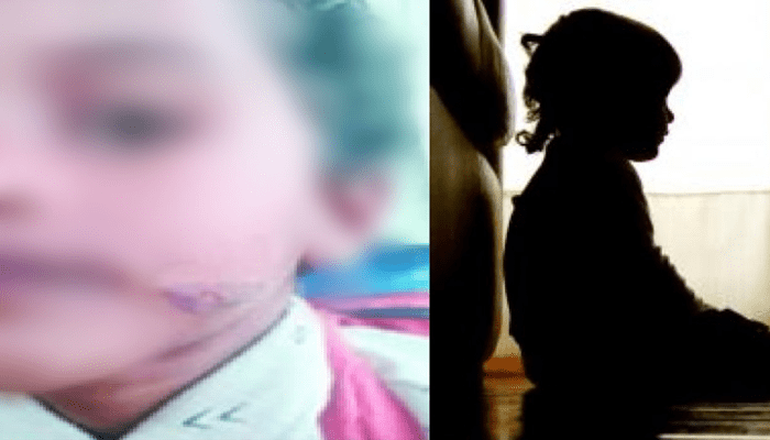 ಬೆಂಕಿಯಲ್ಲಿ ಕಾಯಿಸಿದ ಚಾಕುವಿನಿಂದ ಮಗುವಿನ ಮುಖಕ್ಕೆ ಬರೆ ಎಳೆದ ಅಂಗನವಾಡಿ ಸಹಾಯಕಿ! – ಕಾರಣವೇನು ಗೊತ್ತಾ?