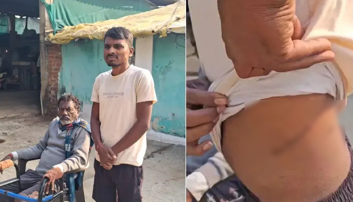 ಸಾಲಗಾರರ ಕಾಟಕ್ಕೆ ಬೇಸತ್ತು ತನ್ನ ಕಿಡ್ನಿಯನ್ನೇ ಸೇಲ್‌ ಮಾಡಿದ ರೈತ!