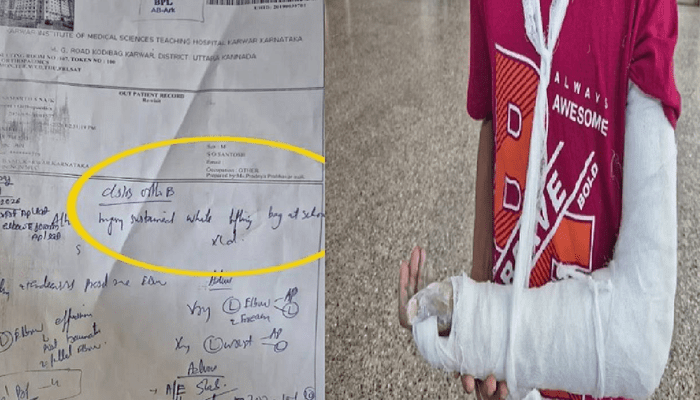 ಸ್ಕೂಲ್‌ ಬ್ಯಾಗ್‌ ಭಾರಕ್ಕೆ ಬಾಲಕನ ಕೈ ಕಟ್!‌ –  ಮಕ್ಕಳಿಗೆ ಚೀಲವೇ ಹೊರೆಯಾಗುತ್ತಿದೆಯಾ?