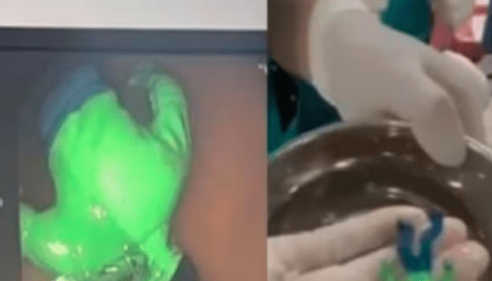 ಅಬ್ಬಬ್ಬಾ.. ಆಟಿಕೆಯನ್ನು ನುಂಗಿದ ಪುಟ್ಟ ಕಂದಮ್ಮ! – ಆಮೇಲೆ ಏನಾಯ್ತು ಗೊತ್ತಾ?