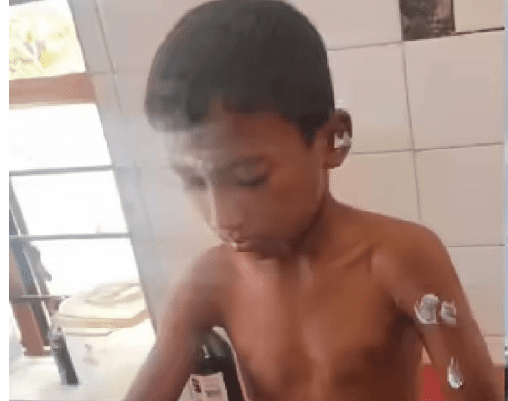 ಮಲೆ ಮಹದೇಶ್ವರ ಬೆಟ್ಟದಲ್ಲಿ ಮತ್ತೆ ಚಿರತೆ ದಾಳಿ – ಪಾದಯಾತ್ರೆ ಹೋಗುತ್ತಿದ್ದ ಬಾಲಕ ಜಸ್ಟ್ ಮಿಸ್