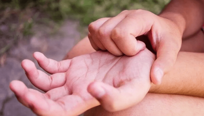 ಪದೇ ಪದೇ ಅಂಗೈ ತುರಿಸುತ್ತಾ? – ಎಚ್ಚರ ನಿಮ್ಮನ್ನು ಈ ಸಮಸ್ಯೆ ಕಾಡುತ್ತಿರಬಹುದು!