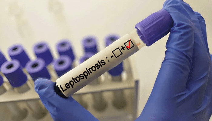 ರಾಜ್ಯದ ಜನರನ್ನು ಕಾಡುತ್ತಿದೆ ಹೊಸ ಮಾದರಿಯ ಸೋಂಕು! – ಭಯಾನಕ ಬ್ಯಾಕ್ಟೀರಿಯಾದಿಂದ ಬಚಾವ್‌ ಆಗೋದು ಹೇಗೆ?