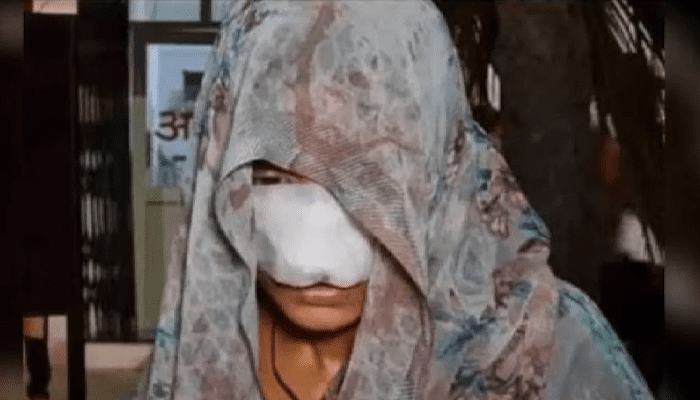 ಗಂಡ-ಹೆಂಡ್ತಿ ಮಧ್ಯೆ  ಜಗಳ!‌ – ಅಯ್ಯಯೋ.. ಗಂಡನ ಸಿಟ್ಟಿಗೆ ಹೆಂಡತಿ ಮೂಗು ಕಟ್!