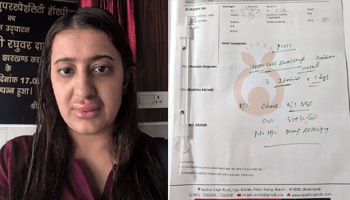 ವಂದೇ ಭಾರತ್ ರೈಲಿನಲ್ಲಿ ಆಹಾರ ಸೇವಿಸಿದ ಮಹಿಳೆ ಶಾಕ್!‌ – ಊಟ ಮಾಡಿದ ಮೇಲೆ ಏನಾಯ್ತು?